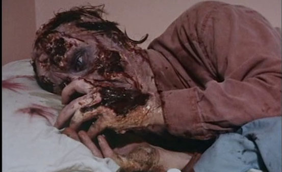 moi-zombie-chronique-de-la-douleur-de-andrew-parkinson